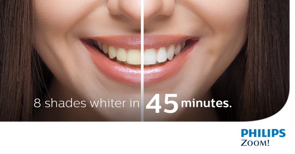 Zoom! Whitening