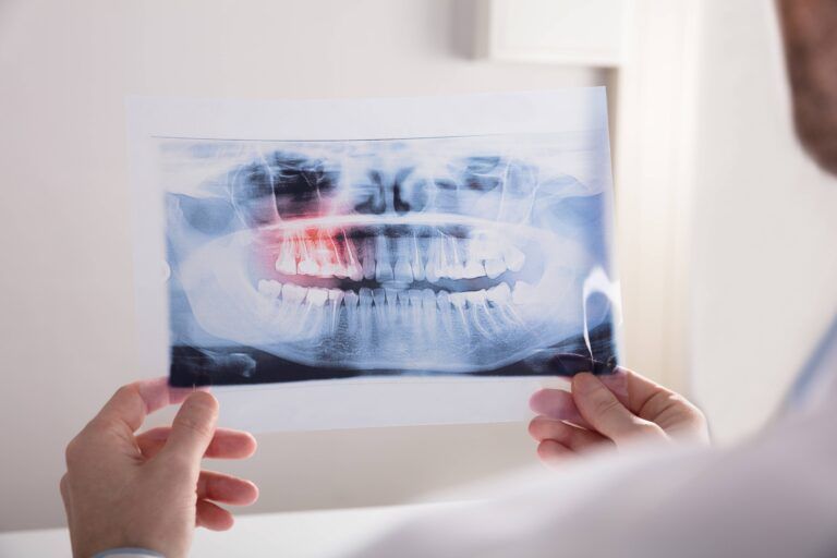Close-up Of A Doctor's Hand Holding Teeth X-ray